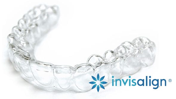 Invisalign braces are not braces, they are clear aligners.