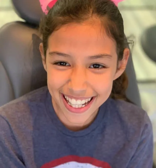 Before Invisalign picture